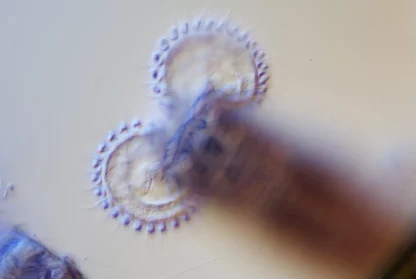 BRESSER MikroCam II 20 MP 1” Microscope Camera - Image 3
